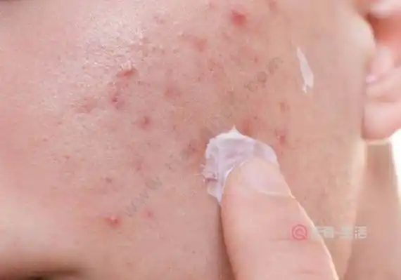 用牙膏洗脸有什么用