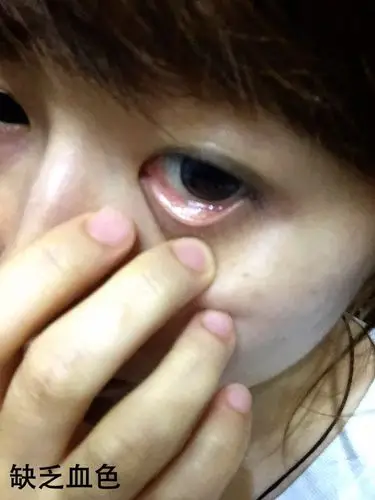 试用-genhao血红素铁,还我气色不再嘴瘪瘪