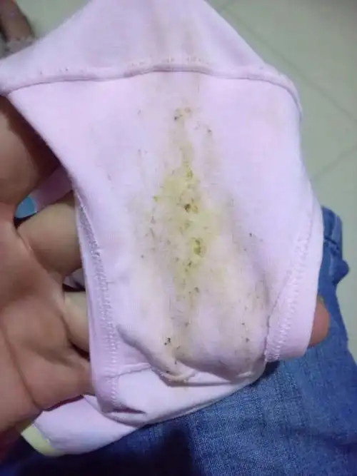 我的女儿7岁了 今年发现 内裤有分泌物 以前有的黄现在有的绿了 怎么