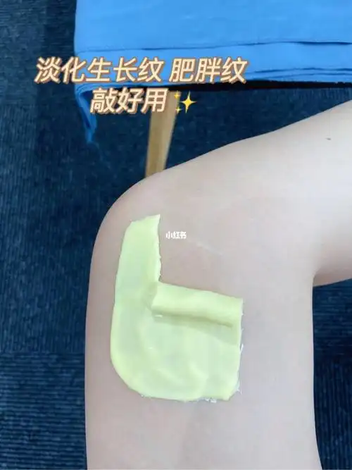 腿露出来了 多尴尬还好找到了方法我用的是软膜粉 淡纹精华油精华油