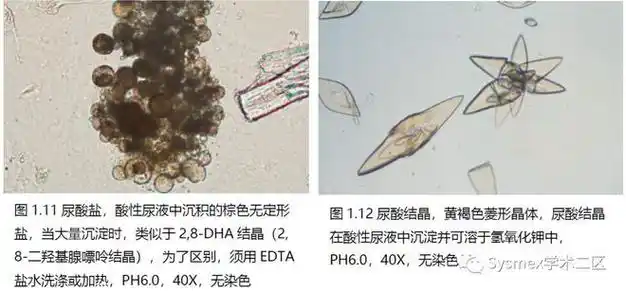高清图谱尿液结晶形态汇总