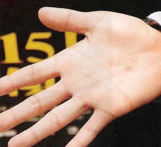 据说刘烨手上有烟头烫伤疤痕,特意百度什么都没有.特来请教,问题如下.