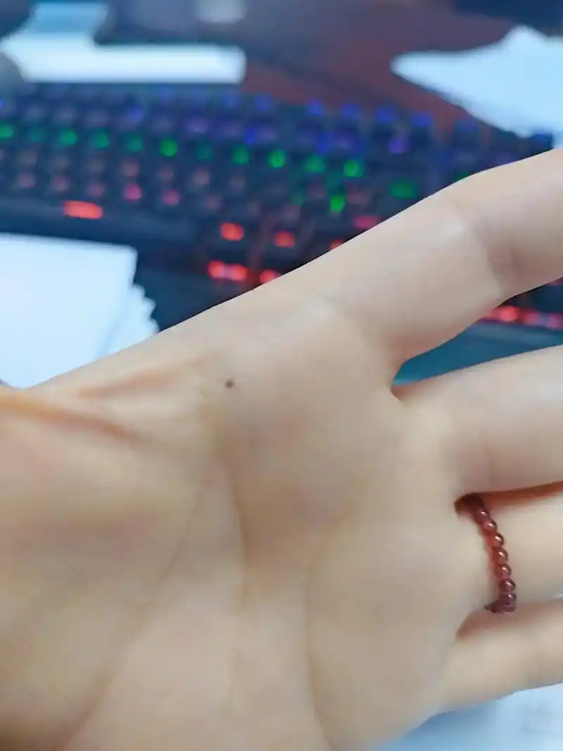 手心木星丘位置不知从何起长了一颗痣#手相面相 #木星丘 - 抖音