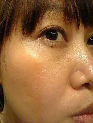 肤色暗沉发黄特显老怎么摆脱黄脸婆3招由内到外白得发光