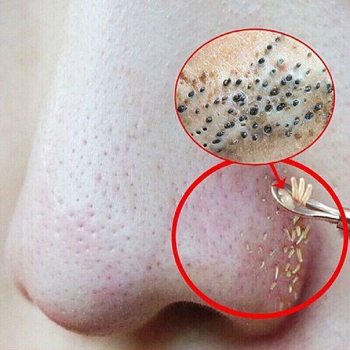 深层毛孔清洁脸部堵塞污垢脏东西按摩膏面部净化平衡皮肤撕拉面膜