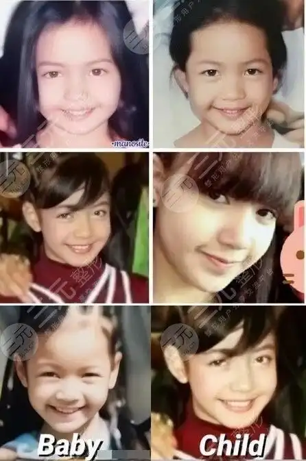 blackpink-lisa整过容吗