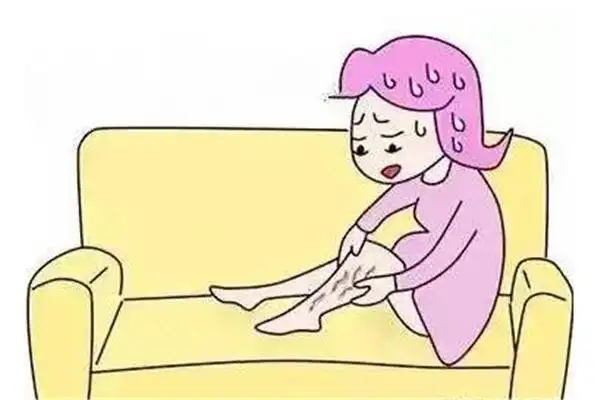 静脉曲张挂哪个科就诊 静脉曲张去医院做什么检查