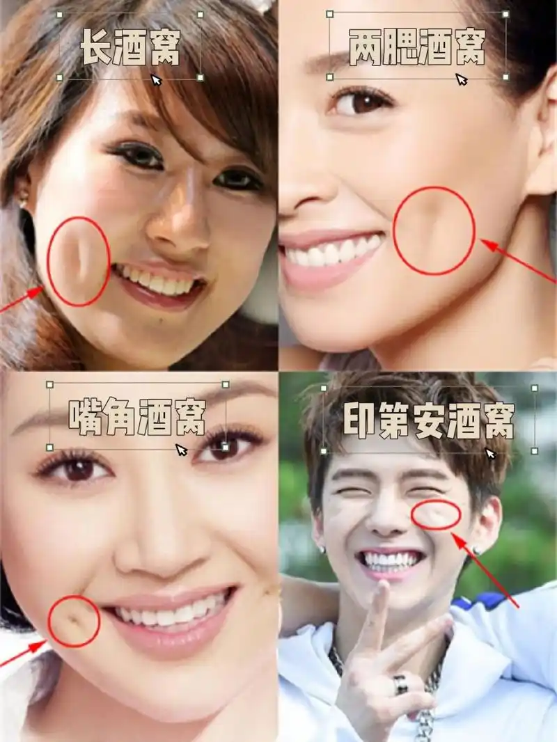 【长酒窝】 	 位置:面颊的两边,笑起来时形成一个狭长的弧度.