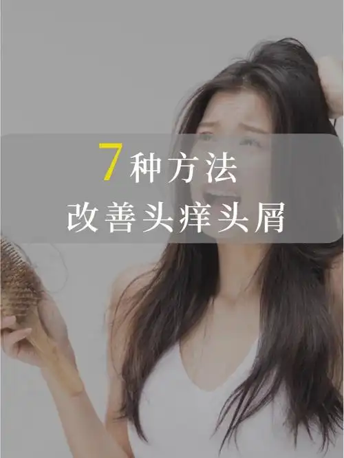 94头痒头屑大概是最常见的头皮问题,也是最不引人注意的头皮问题