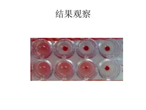 实验2,凝集反应(一)ppt