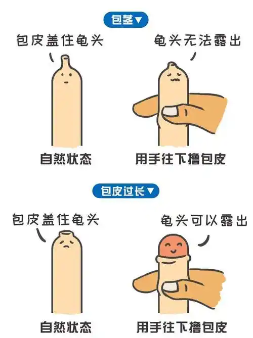 小孩包皮过长(小孩包皮过长几岁做手术合适)