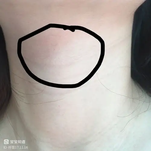 孕期你们脖子长毛了吗突然发现自己脖子都长毛了