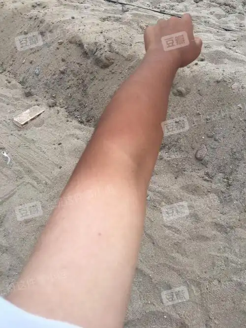 苹果手机原相机拍摄,纯晒黑,不是脏的,洗完也是这个颜色