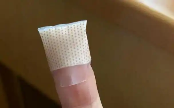 创口贴,你可能一直没用对|创可贴|包扎|烫伤|创面_网易订阅