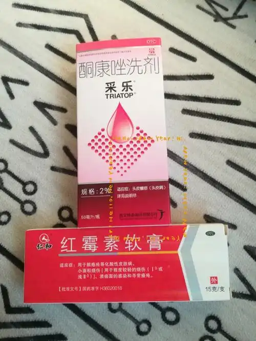 头皮毛囊炎药物治疗