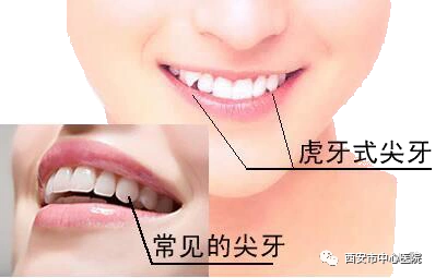 科普知识虎年话虎牙