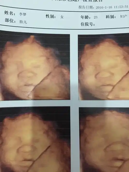 四维宝宝鼻子很大吗?