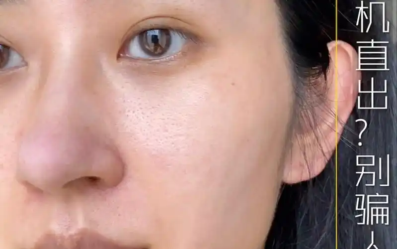 普通人的真实皮肤 | 原相机 美颜相机状态下滴皮肤_哔哩哔哩_bilibili