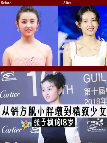 从斜方肌小胖墩到精致少女张子枫的18岁