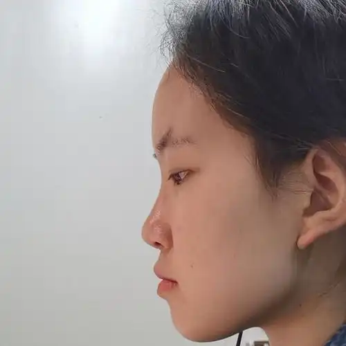 想请uu们帮忙看一下我的侧脸