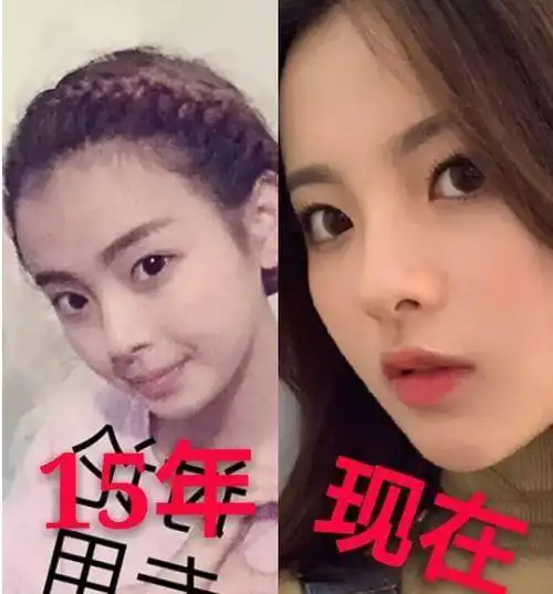 火箭少女101的门面担当杨超越也被爆出整过容了