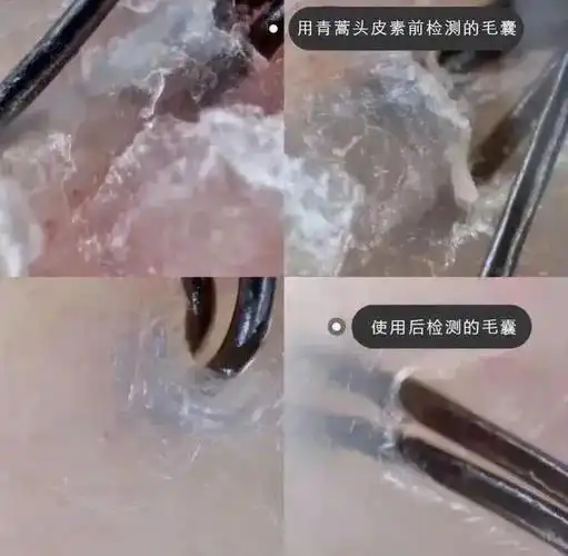 久用不仅发根强韧,不易掉,之前有些秃秃的额角也慢慢长出了绒毛.