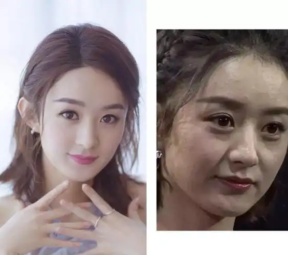 赵丽颖就属于油皮,皮肤状态不好下的高清未修图就可以看出.