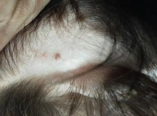 蛋蛋上长了痘痘一样的东西是什么