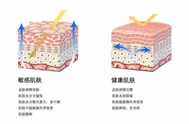 皮肤角质层过薄怎么办护肤专家提出的3个方法一定要牢记
