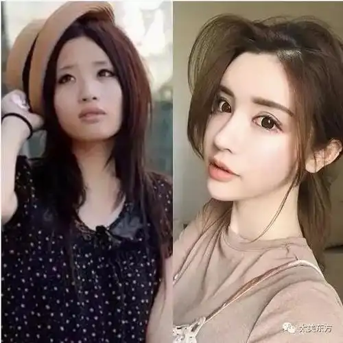 今天就跟小编一起八一八这些国内外网红们整容前后对比图~前方高能!