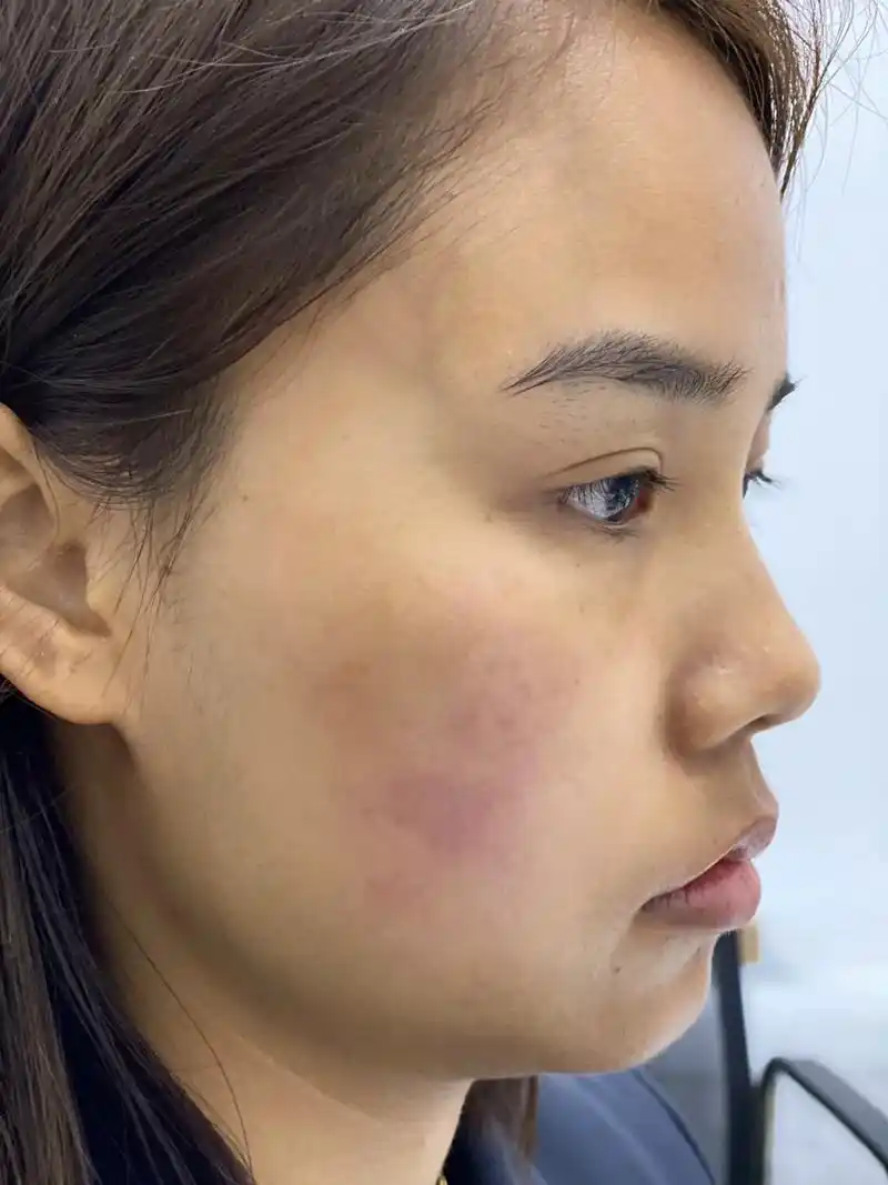 3年屏障受损上岸我总结了几点 1.洗脸要温和 2.厚养 - 抖音