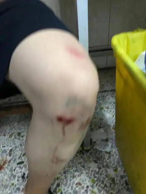 热议外卖小哥遭多人殴打身上多处受伤