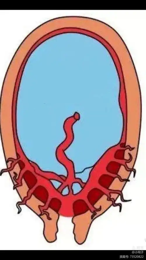 市中心医院多学科协作,成功救治凶险性前置胎盘产妇|剖宫产|子宫_网易