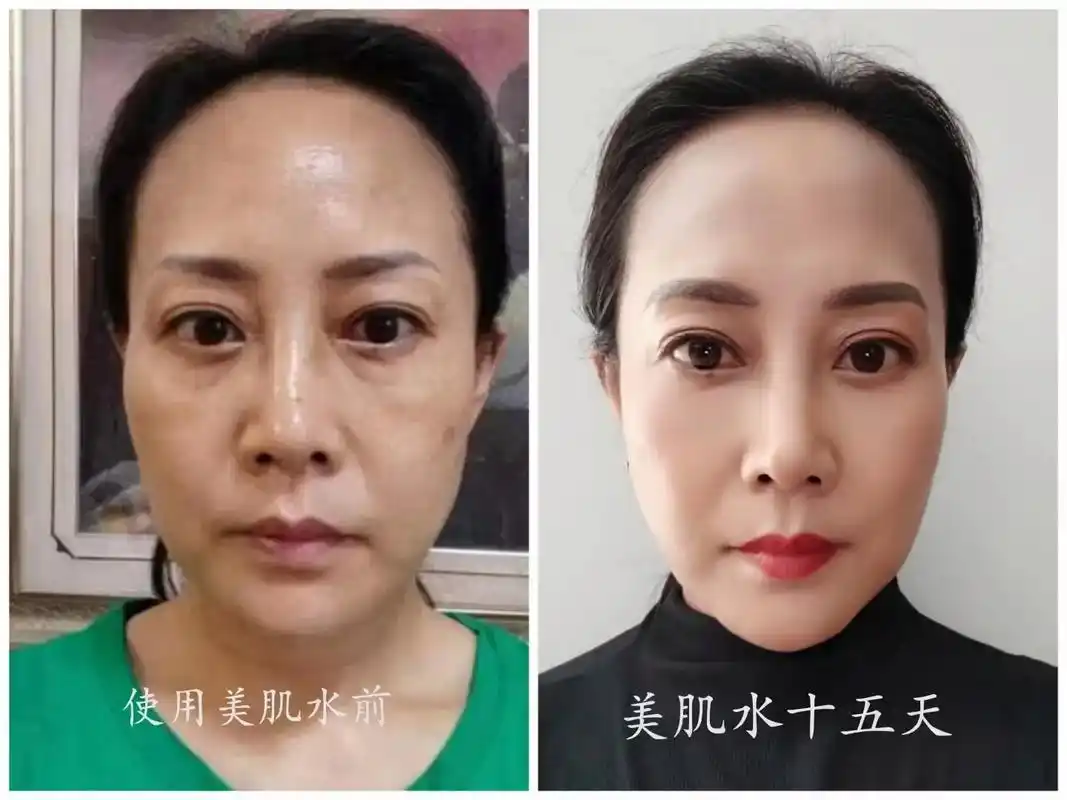 美肌水使用前后对比照:皮肤细腻紧致,眼袋,法令纹变,脸都小了 - 抖音