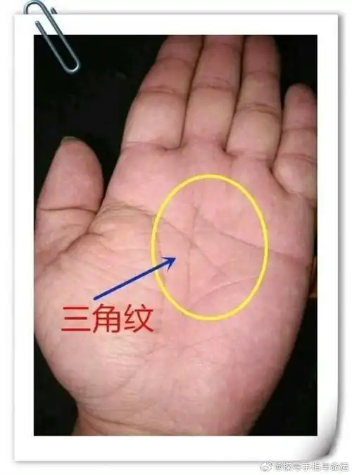 有这些手相特征的女人,也会有好的命运一,手背上长痣女人的手背上如果