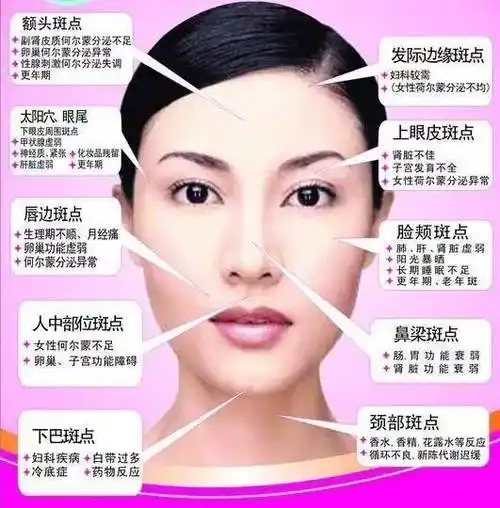 健康小贴士小心女人脸上这些地方长斑是妇科病的征兆哦