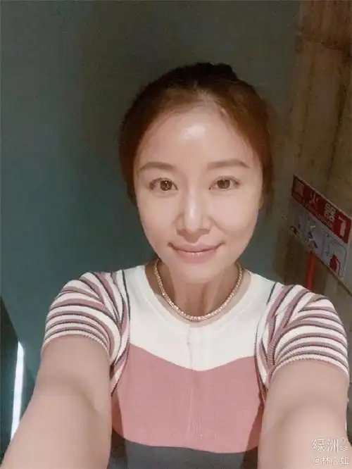 44岁林心如近照被指脸肿显老,她大方晒出素颜照回应