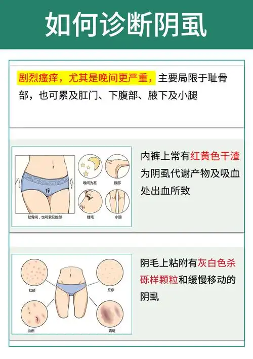 阴虱男私处用10硫磺软膏去虱子乳膏百部酊喷雾林ld旦乳膏孕妇女成人用