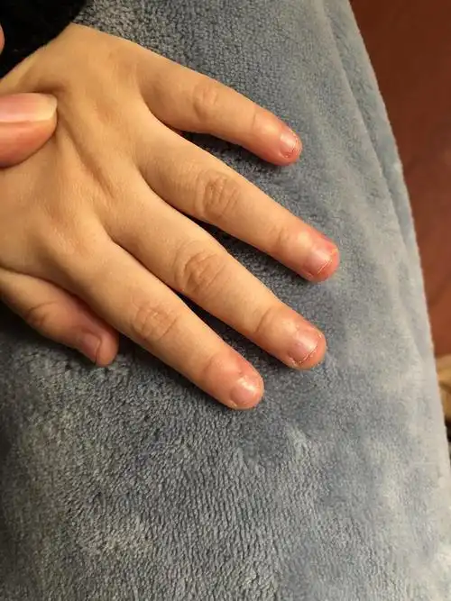 求助大家,孩子老是咬指甲怎么办?