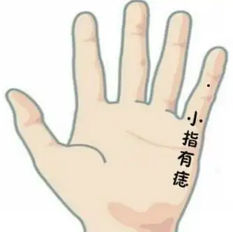 手指上有痣图解:手指上有痣代表什么意思,手指上有痣的人代表什么