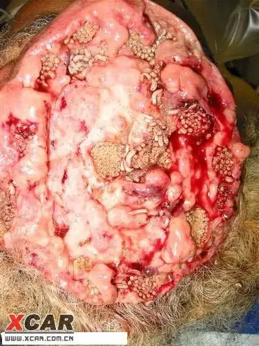 史上最恶心的图片---18岁以下勿入