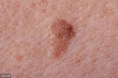 感染后有什么症状(感染后会出现什么症状) - 医药经