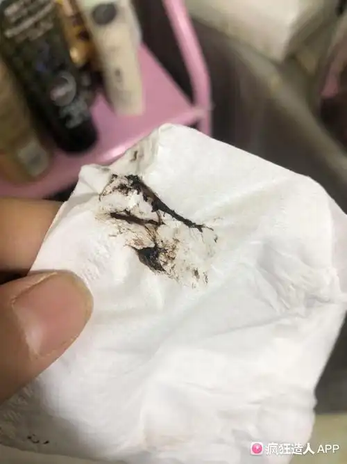 怀孕八周突然出了一股褐色血随后便黑色分泌物