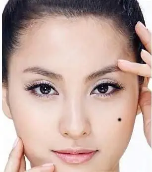 这5个地方长痣,是天生的富贵命,一辈子大富大贵