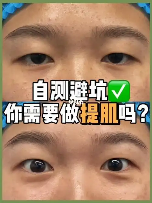 自测提肌无力?你的方法可能用错了!