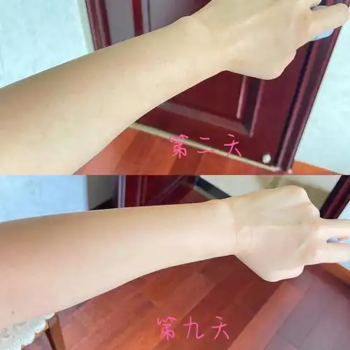 美斯蒂克美白饮第九天77对比图