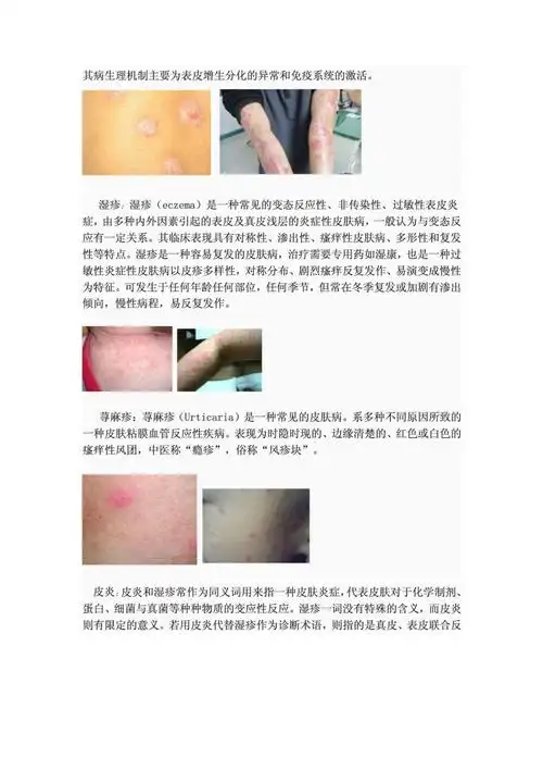 常见皮肤病的种类及症状图片简介大全
