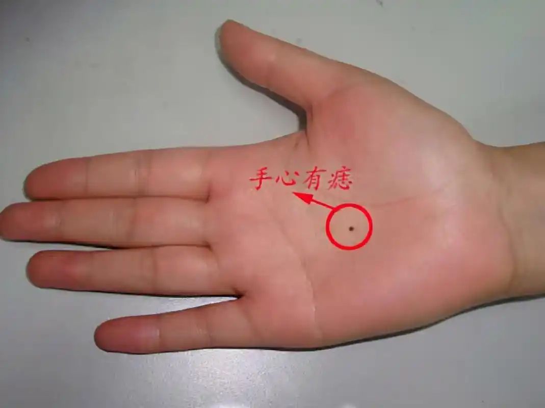 为啥多数孩子手心都有一颗"痣"?网友:没有铅笔痣的童年不完整