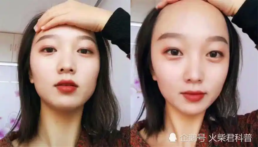 "发际线"太高对女生颜值影响有多大?撩起刘海后,男生拔腿就跑