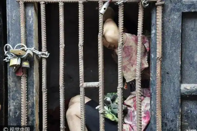 35 岁女子17岁时突患 "怪病 ",被家人锁在笼子里圈养!